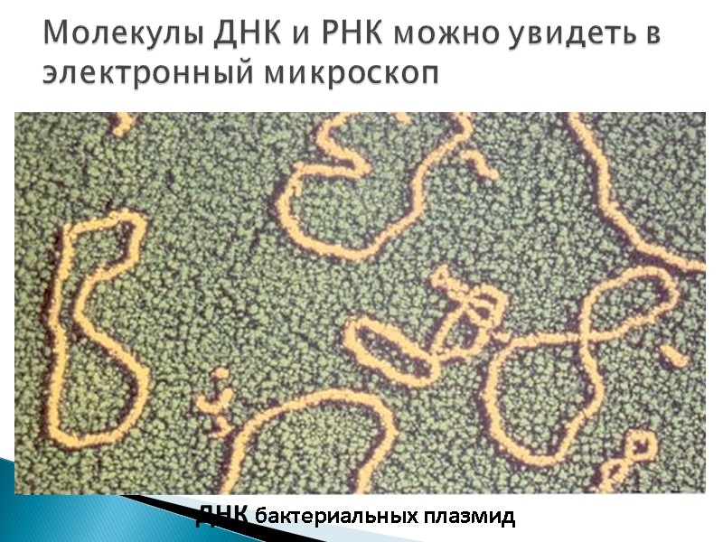 Молекулы ДНК и РНК можно увидеть в электронный микроскоп ДНК бактериальных плазмид